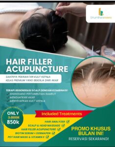 Hair Filler Acupuncture